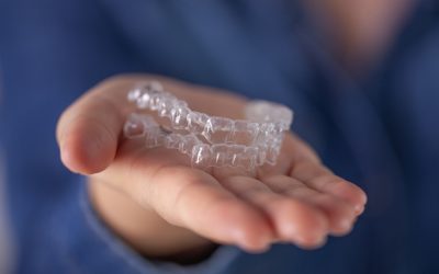 How Invisalign Works: The Science Behind Clear Aligners